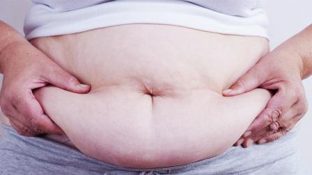 女人肥胖也会影响试管婴儿成功率