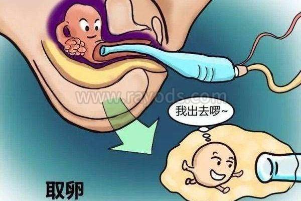 中国试管婴儿的方方面面：人工授精的适应症