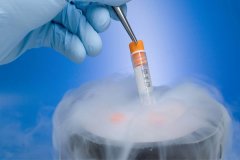 3泰国试管婴儿的冷冻胚胎移植选择。