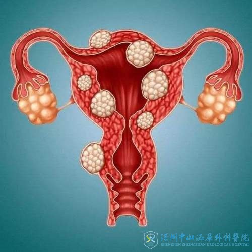 杭州助孕机构嘉aa69行不行-什么是卵巢囊肿，它们是否影响试管婴儿的成功率？