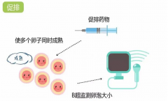 台州供卵试管中介哪家好-解释一下不同排卵方案对卵子质量的影响。